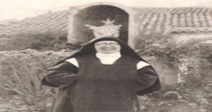Procedure - Pedro della Madre di Dio